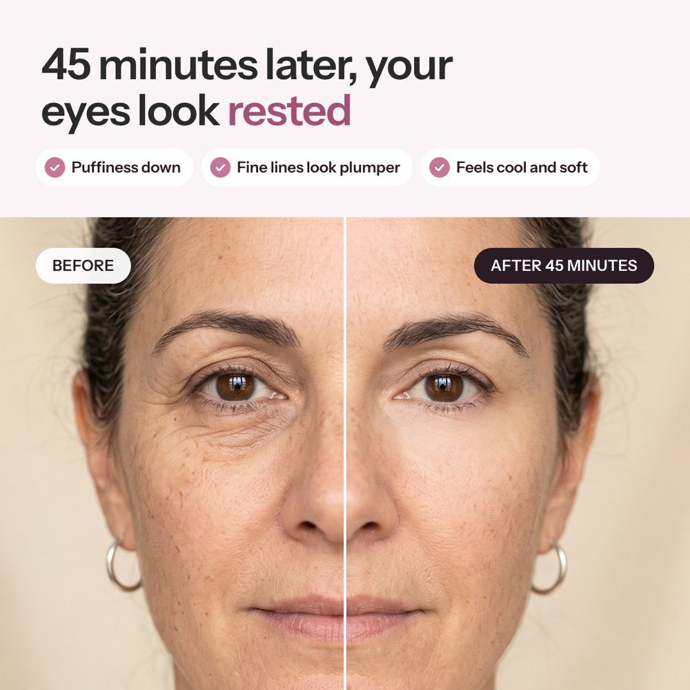 45 minutes later, your eyes look rested: before and after